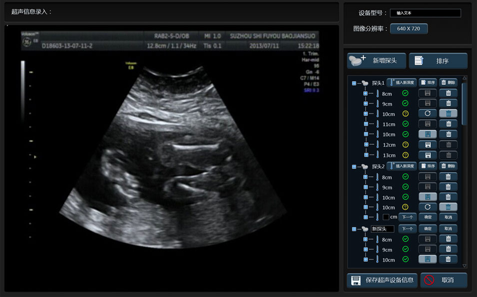 武漢睿影醫(yī)療科技超聲系統(tǒng)軟件界面設計